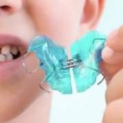 ortodoncia removible infantil