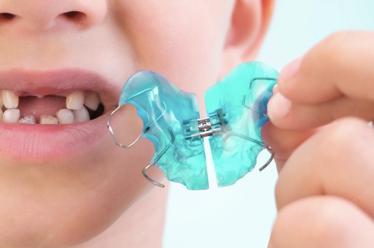 ortodoncia removible infantil